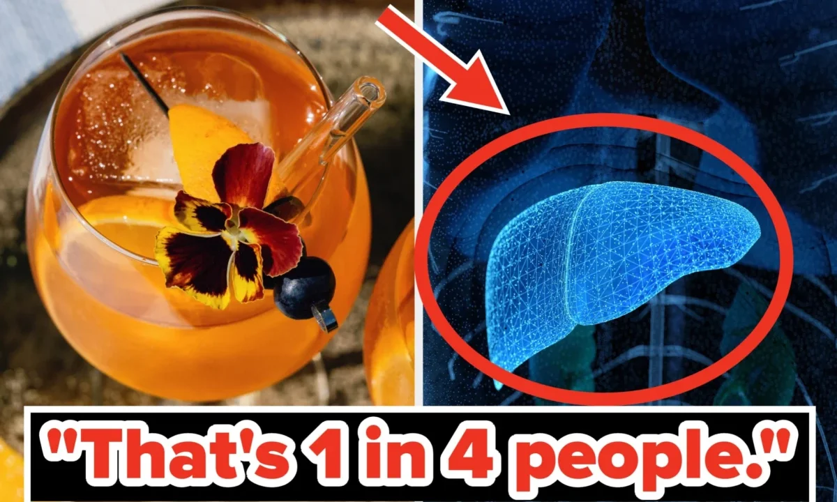 The Silent Epidemic: How Dietary Choices Fuel MASLD—And 3 Foods to Eliminate Immediately